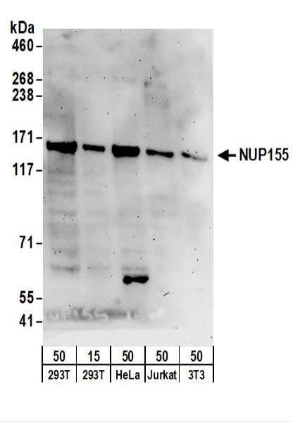 Polyclonal Rabbit anti-Human NUP155 Antibody (aa1341-1391, WB)