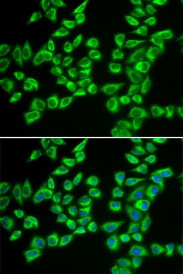 IHC-plus™ Polyclonal Rabbit anti-Human HADHB Antibody (IHC, IF, WB)