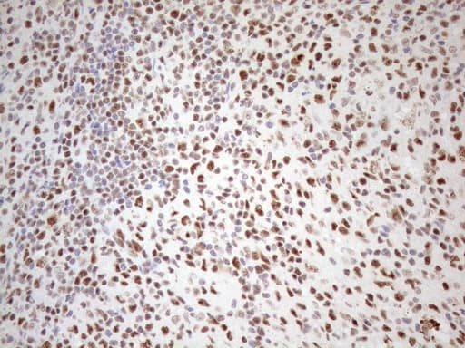 Monoclonal Mouse anti-Human WTAP Antibody (clone OTI12G7, aa2-106, IHC, WB)