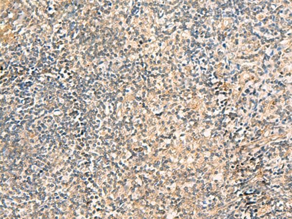 Polyclonal Rabbit anti-Human TXNDC12 Antibody (IHC)