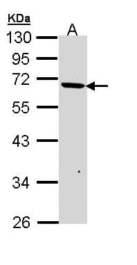 JMJD6 / PSR Antibody (aa1-234)