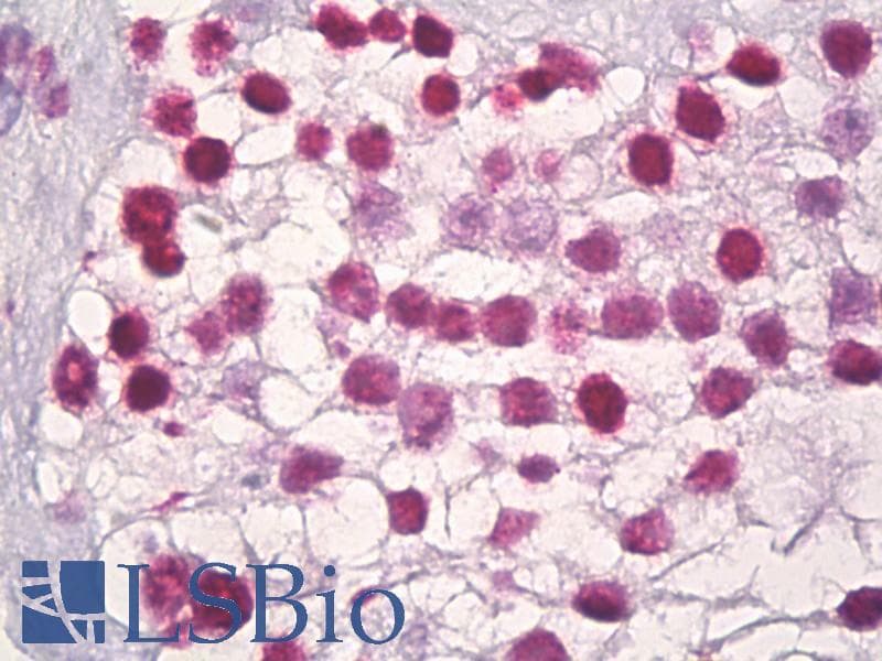 IHC-plus™ Polyclonal Rabbit anti-Human Histone H3 Antibody (aa1-50, IHC, WB)