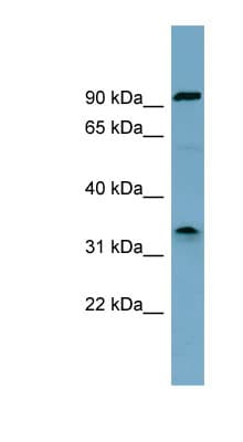 Polyclonal Rabbit anti-Human SDS Antibody (aa215-264, WB)