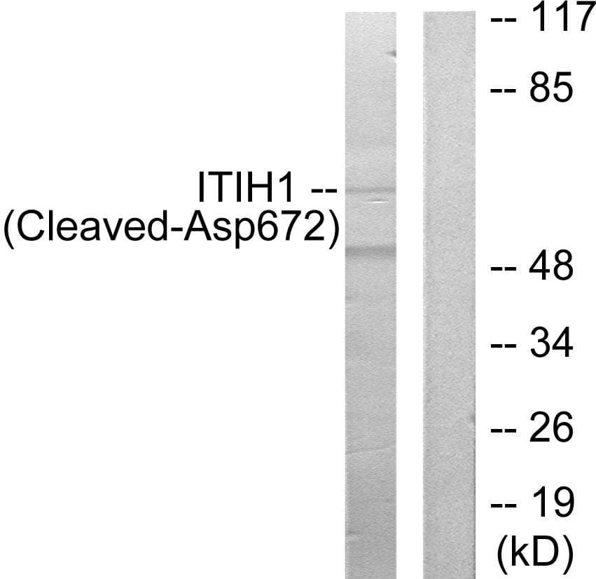 ITIH1 Antibody (Cleaved-Asp672)
