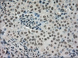 DHFR Antibody (clone OTI3A11, Carrier-free)