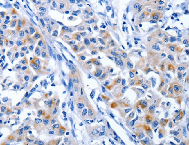 CRD-BP / ZBP1 / IGF2BP1 Antibody