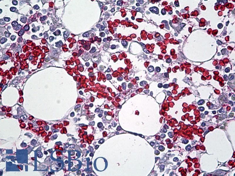 IHC-plus™ Polyclonal Rabbit anti-Human RBC / Red Blood Cells Antibody (IHC)