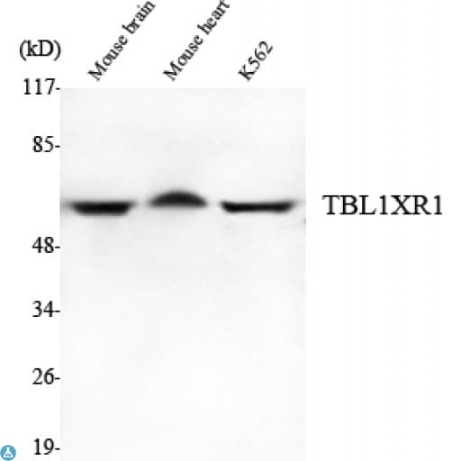 TBL1XR1 / TBLR1 Antibody