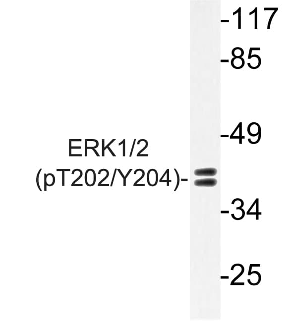 ERK1 + ERK2 Antibody (phospho-Thr202)