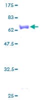 Human GALK1 / GK1 Protein (Recombinant GST)
