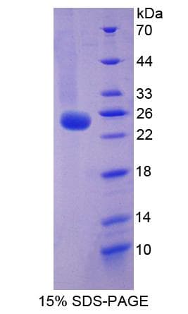 Human BRINP3 / FAM5C Protein (Recombinant His-S)