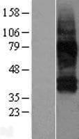 SLC38A3 / SNAT3 Protein (Over-Expression Lysate Myc-DDK (Flag))