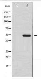Polyclonal Rabbit anti-Human Vitamin D Receptor / VDR Antibody (IHC, IF, WB)