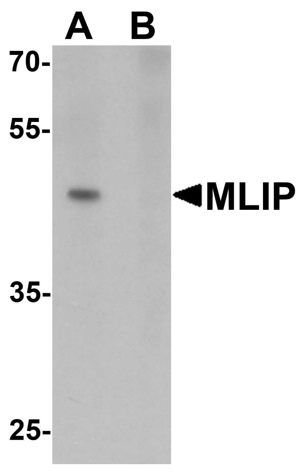 IHC-plus™ MLIP Antibody