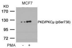 PRKD1 / PKC Mu Antibody