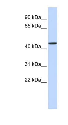 Polyclonal Rabbit anti-Human JMJD4 Antibody (aa72-121, WB)