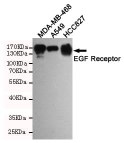 Monoclonal Mouse anti-Human EGFR Antibody (IHC, WB)