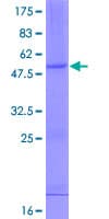 Human IFNA10 / Interferon Alpha 10 Protein (Recombinant GST)