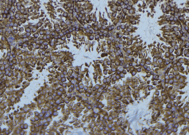 Polyclonal Rabbit anti-Human WAS / WASP Antibody (IHC, IF, WB)