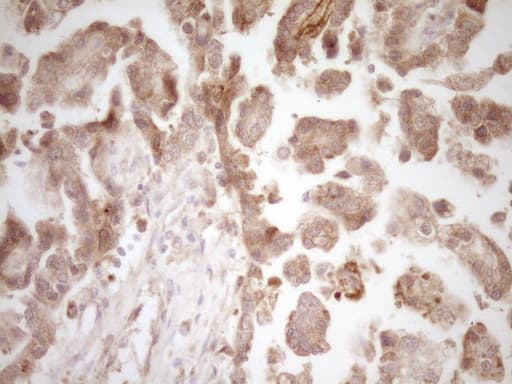 Monoclonal Mouse anti-Human CALCA Antibody (clone 2D12, IHC, WB)