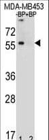 TNRC9 / TOX3 Antibody (aa214-242)