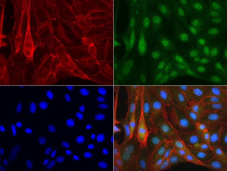 ERCC4 / XPF Antibody (clone UMAB20, Carrier-free)