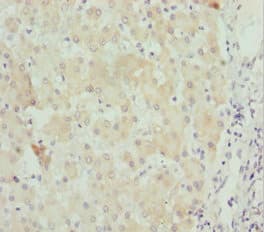 STXBP2 Antibody