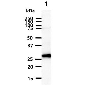 CALB2 / Calretinin Antibody (clone AT5C5)