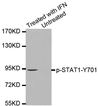 STAT1 Antibody (phospho-Tyr701)