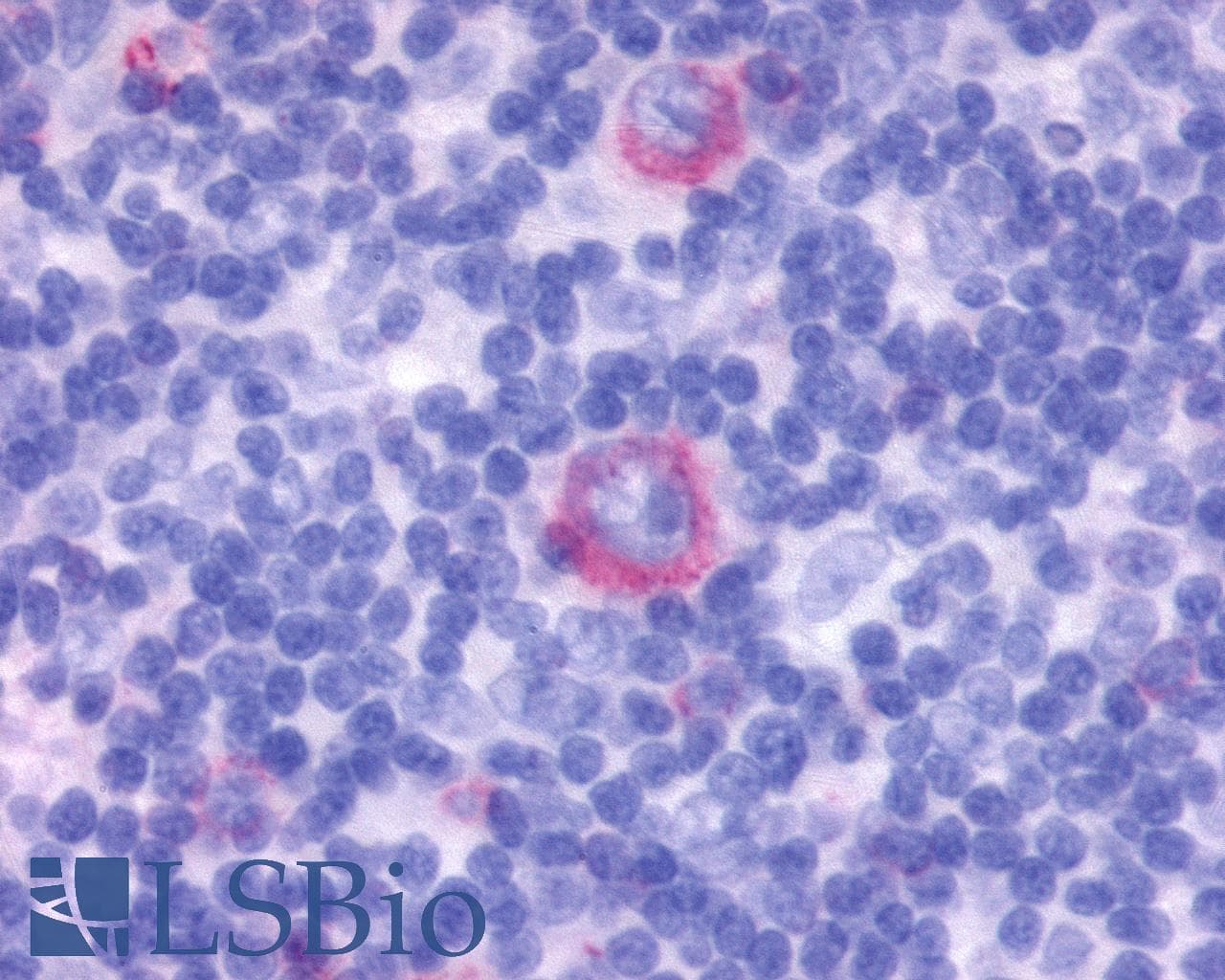 PathPlus™ GPR137 Antibody (Extracellular Domain)