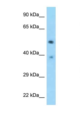 TSEN2 Antibody (aa395-444)