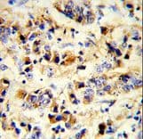 EGFR Antibody