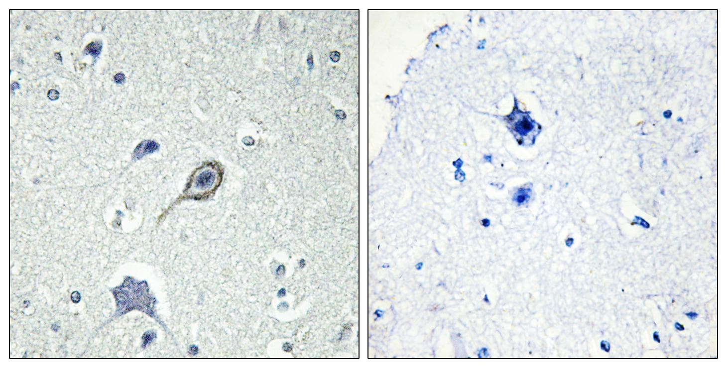 Polyclonal Rabbit anti-Human CNR1 / CB1 Antibody (IHC, IF, WB)