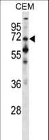 Polyclonal Rabbit anti-Human PPEF / PPEF1 Antibody (aa298-327, WB)