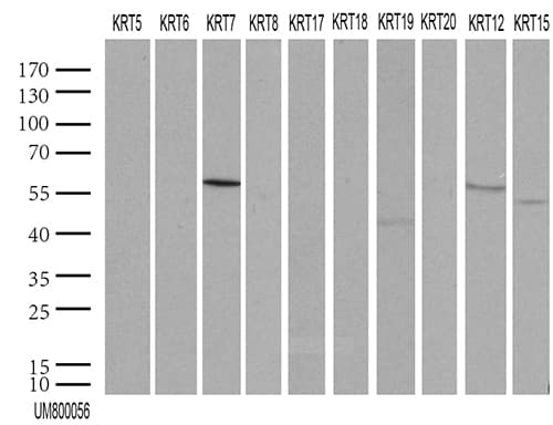 KRT7 / CK7 / Cytokeratin 7 Antibody (aa1-114, clone UMAB161, Carrier-free)