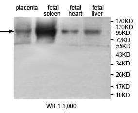 Polyclonal Rabbit anti-Human KDM7A / JHDM1D Antibody (aa586-601, IHC, WB)