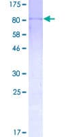 Human CNOT2 Protein (Recombinant GST)