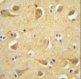 Polyclonal Rabbit anti-Human CLTC / Clathrin Heavy Chain Antibody (aa1019-1048, IHC, WB)