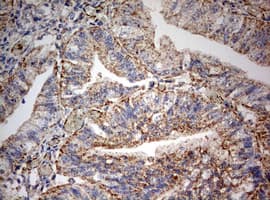 PARN Antibody (aa1-266, clone OTI4D12)