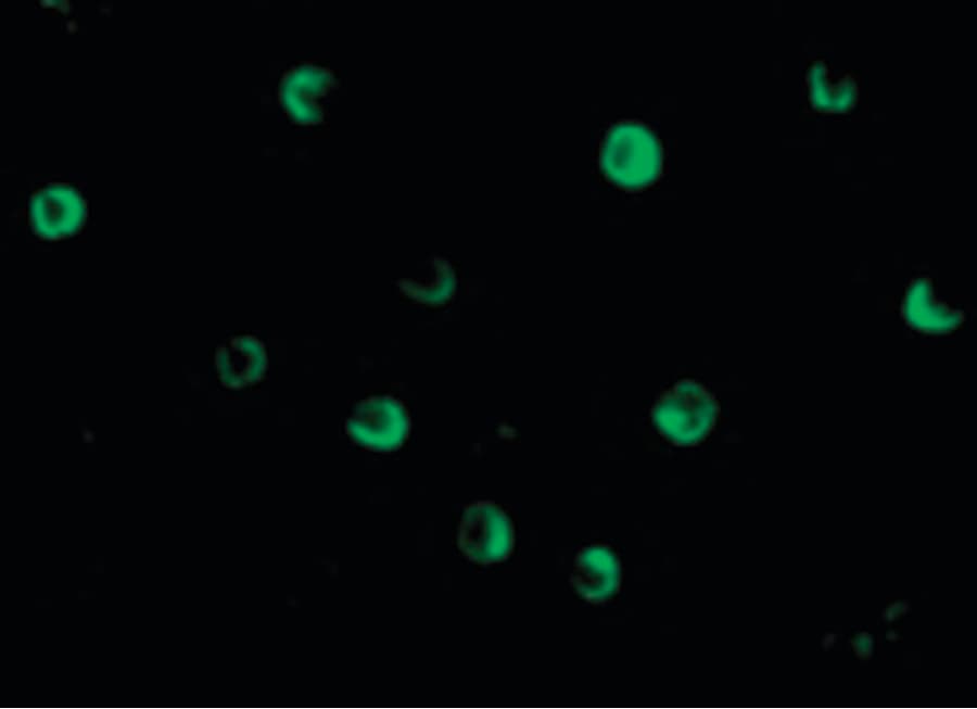 IHC-plus™ Polyclonal Rabbit anti-Human NOD2 / CARD15 Antibody (IHC, IF, WB)