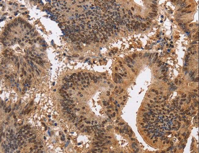 Polyclonal Rabbit anti-Human KCNG2 Antibody (IHC, WB)