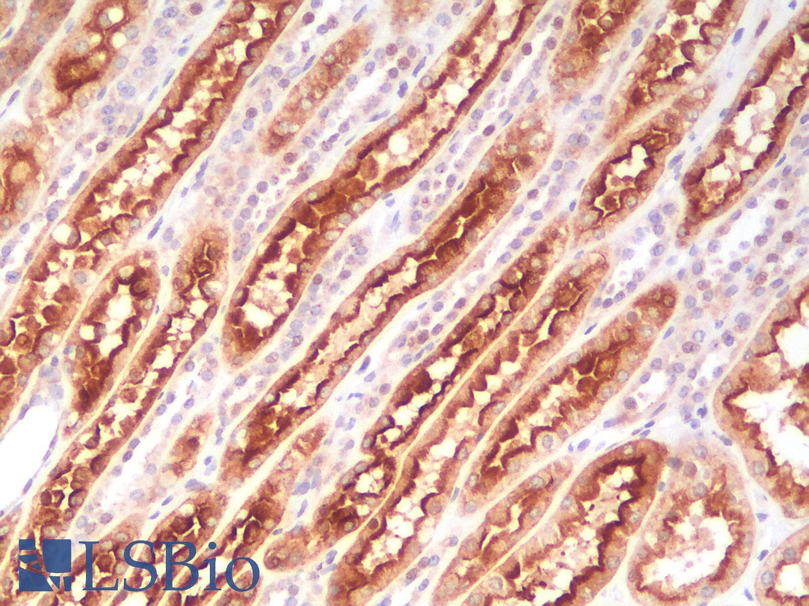 PathPlus™ Recombinant Monoclonal Mouse anti-Human VIL1 / Villin Antibody (clone rVIL1/1325, aa179-311, IHC)
