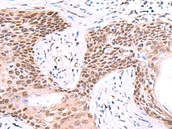 Polyclonal Rabbit anti-Human IRF2BP1 Antibody (IHC)
