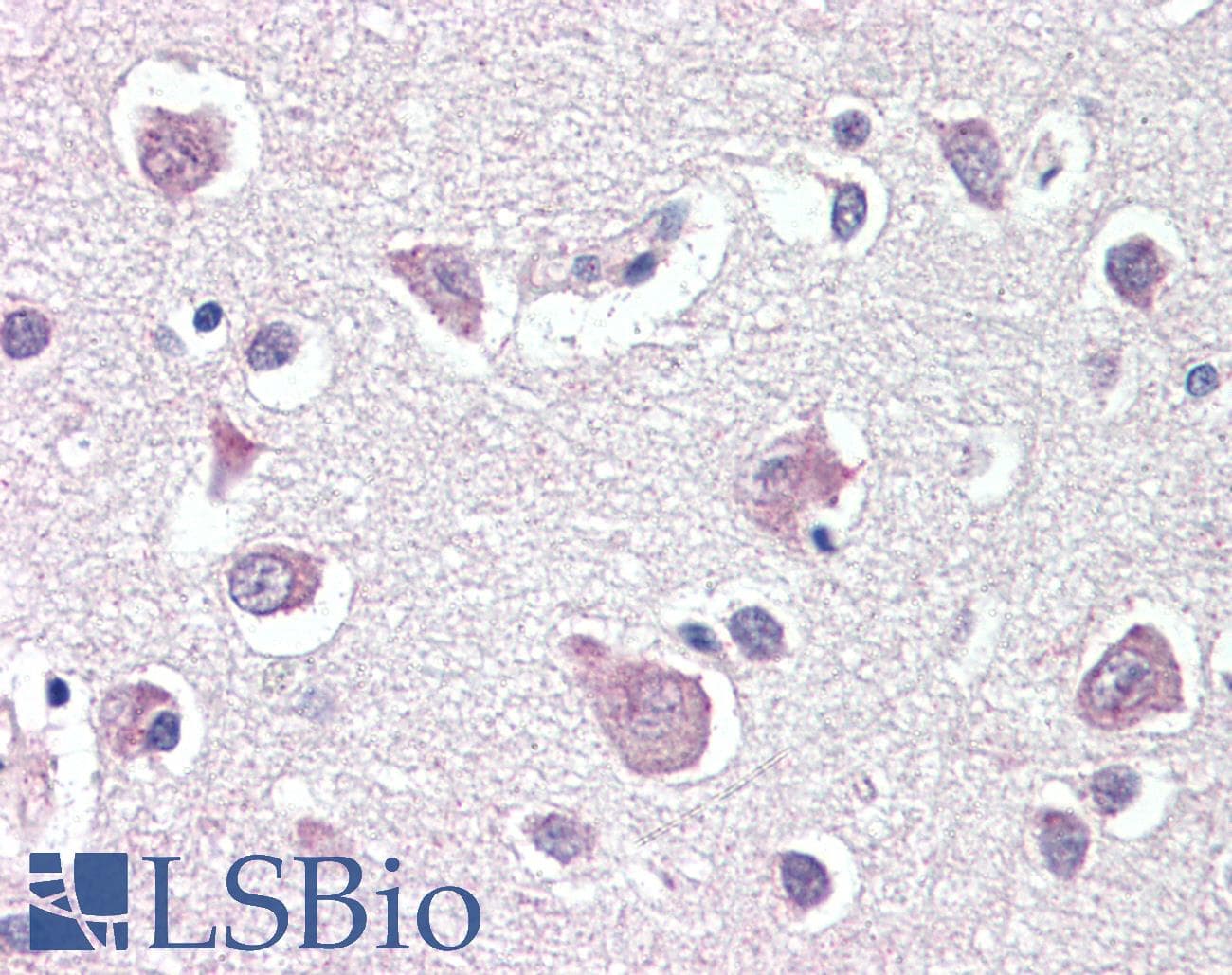 IHC-plus™ Polyclonal Rabbit anti-Human THY1 / CD90 Antibody (aa36-65, IHC, WB)