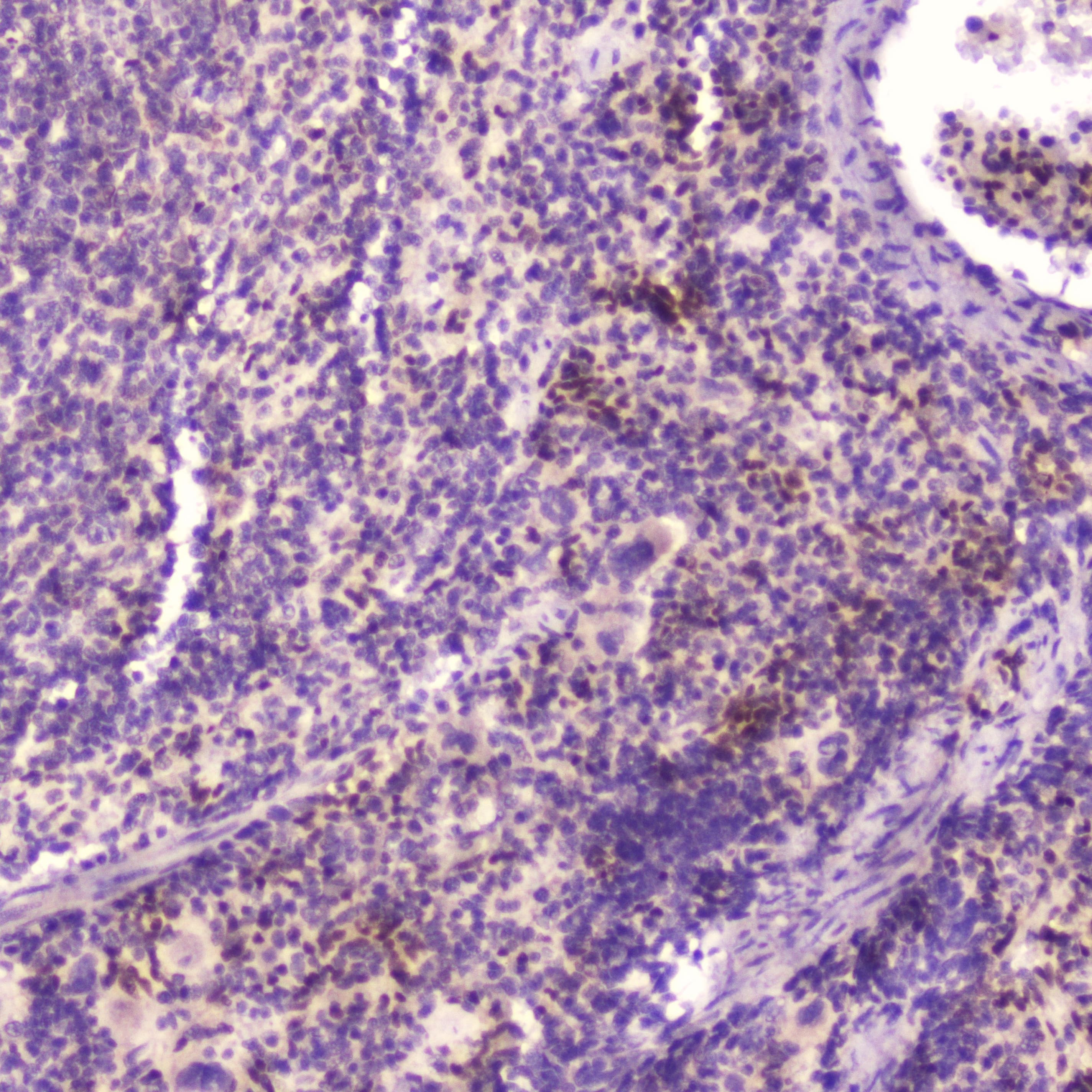 KLF4 Antibody