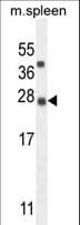 KIAA1143 Antibody (aa3-30)