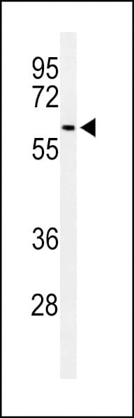 SNX27 Antibody (aa313-340)