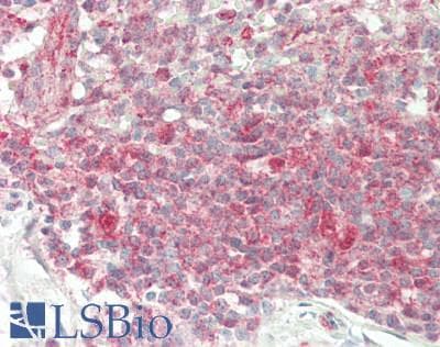 IHC-plus™ UCHL5 / UCH37 Antibody (aa150-200)