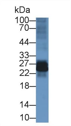 IL-22BP / IL22RA2 Antibody (aa31-223)