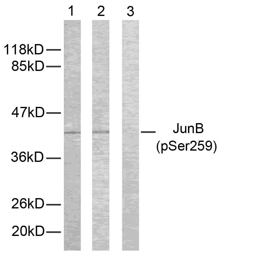 Polyclonal Rabbit anti-Human JUNB / JUN-B Antibody (phospho-Ser259, IHC, WB)